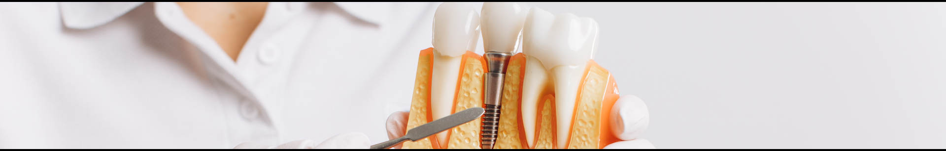 implants dentaires abidjan